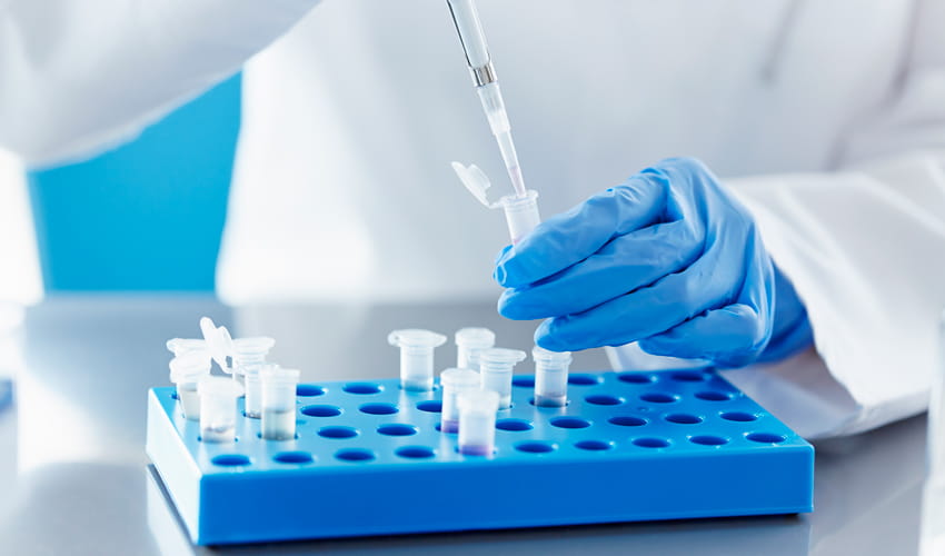 Pharmacodynamic Biomarker Testing